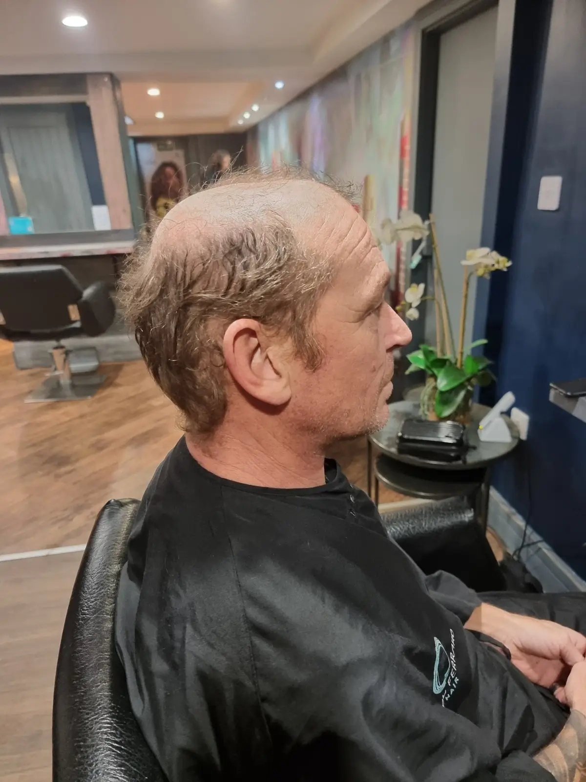 mens hair treatment harrogate before